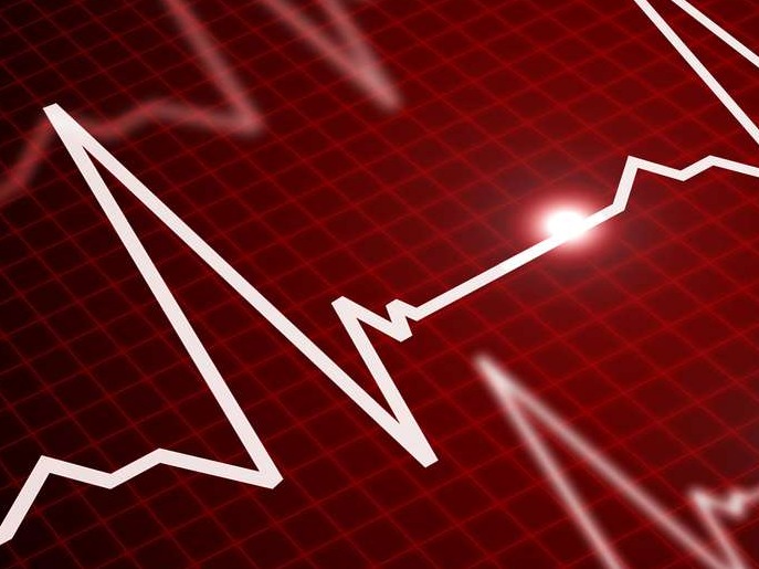 Fréquence cardiaque: quelle est la bonne zone?